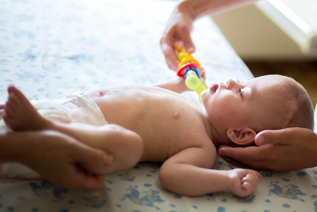 Рання реабілітація